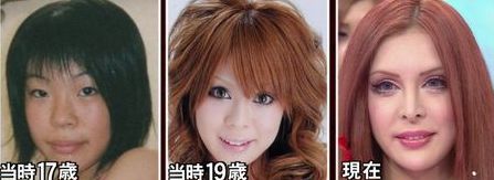 ヴァニラ整形前と現在!本名と年齢・元の顔からの変化まとめ【画像あり】