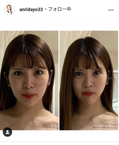 【整形】坂口杏里の現在!顔の変化や激やせを画像で比較検証!【メンヘラ】