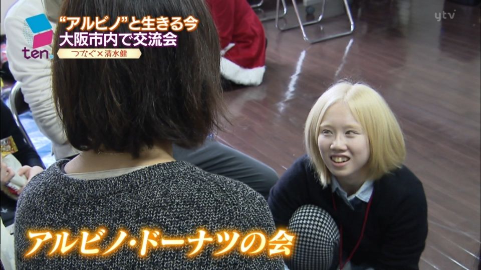 アルビノの日本人&モデル20人まとめ!人間と動物の画像あり