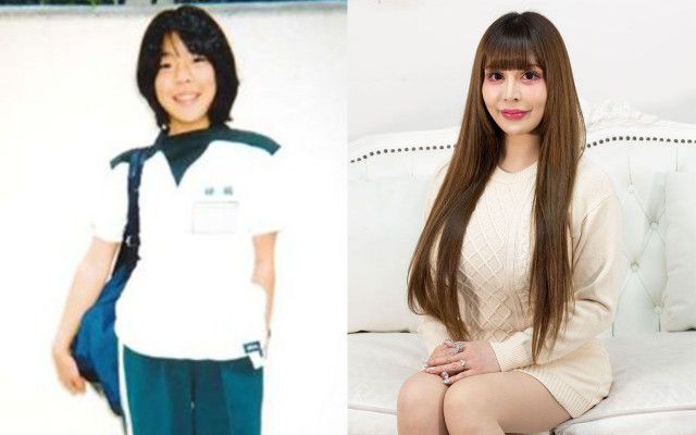 ヴァニラ整形前と現在!本名と年齢・元の顔からの変化まとめ【画像あり】